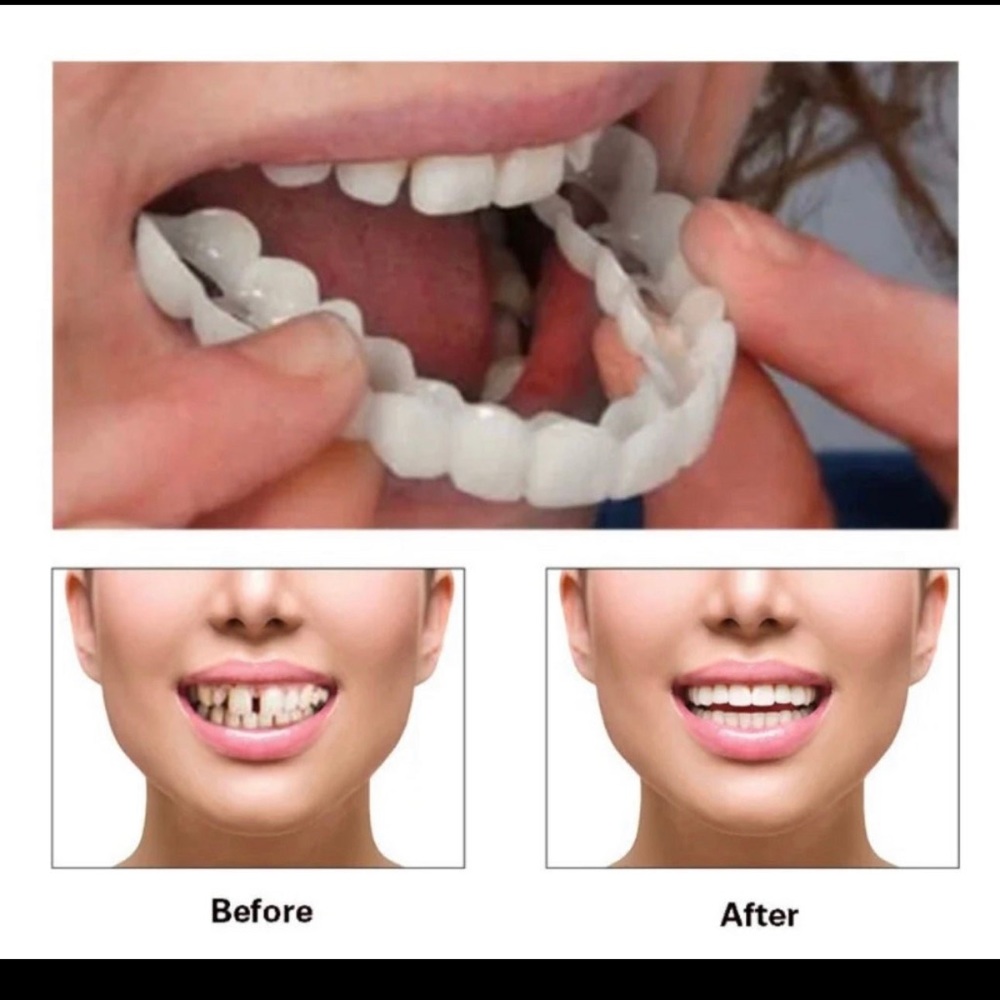 False teeth snap on smile removable reusable temporary new fake teeth
